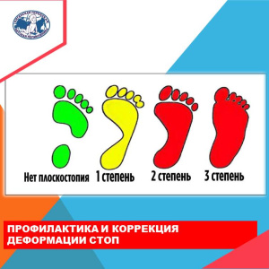 Советы врача травматолога - ортопеда по профилактике плоскостопия 