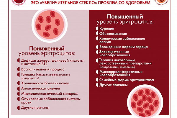 Специалистами ФГБУ «НМИЦ гематологии» Минздрава России разработана серия инфографики, где в простой и доступной форме представлена информация о заболеваниях системы крови