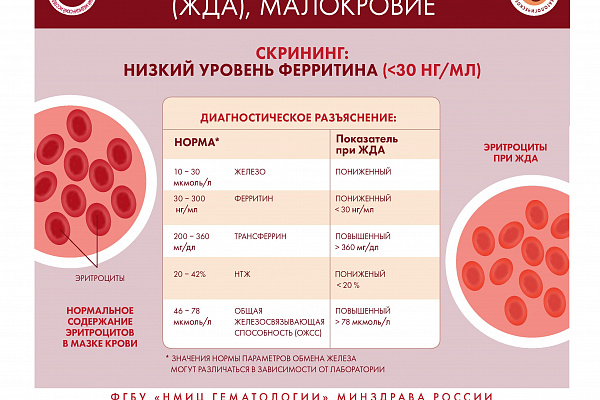 Специалистами ФГБУ «НМИЦ гематологии» Минздрава России разработана серия инфографики, где в простой и доступной форме представлена информация о заболеваниях системы крови